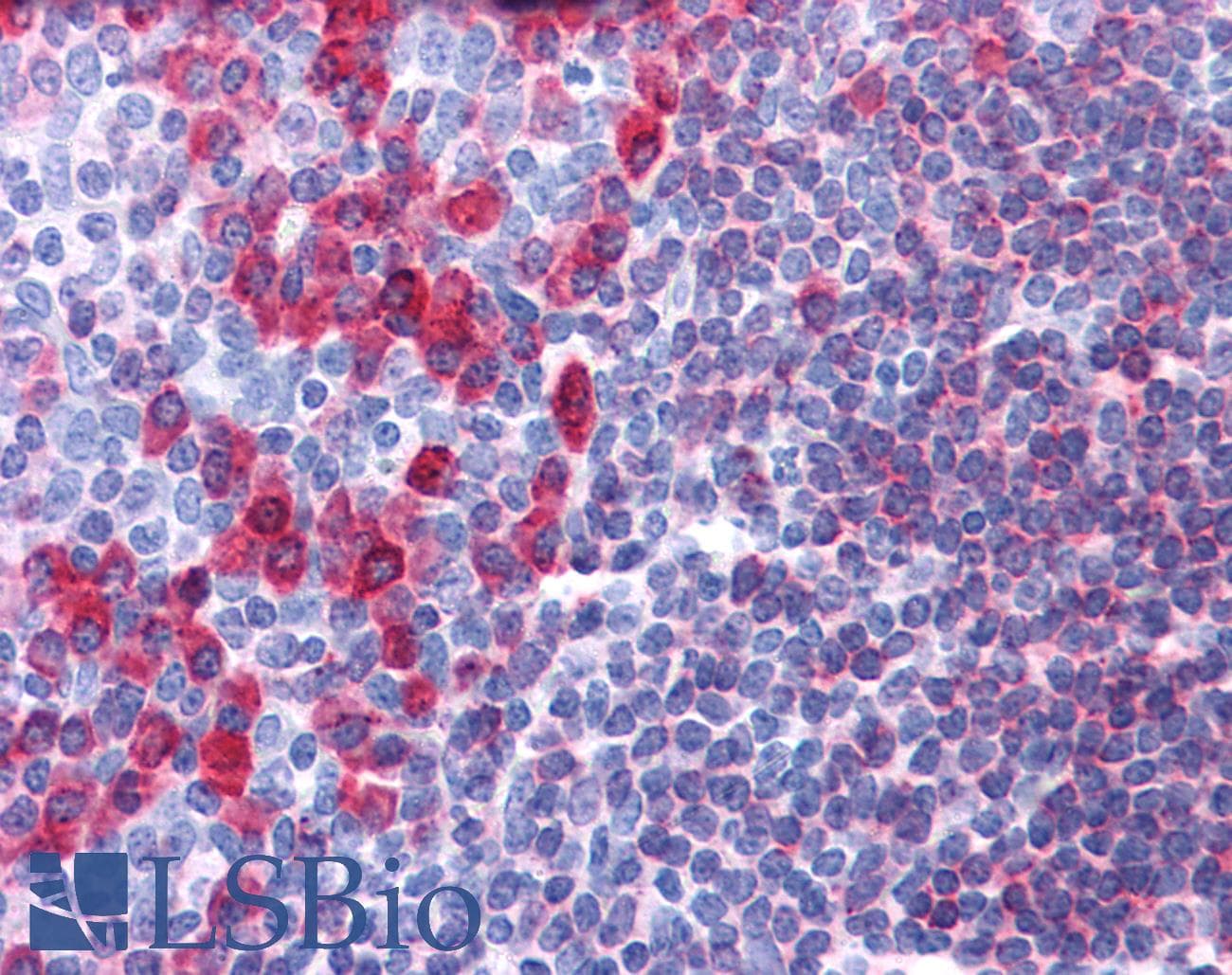 IHC-plus™ CD79A / CD79 Alpha Antibody (clone HM57)