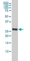BCL2L1 / BCL-XL Antibody (clone 3E2-2A5)
