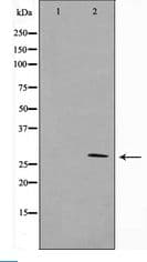 Polyclonal Rabbit anti-Human YWHAZ / 14-3-3 Zeta Antibody (IHC, IF, WB)