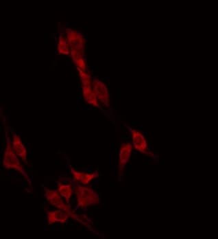 CAGE1 / Cancer Antigen 1 Antibody