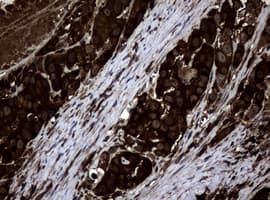 NME1 / NM23 Antibody (clone OTI6E8)