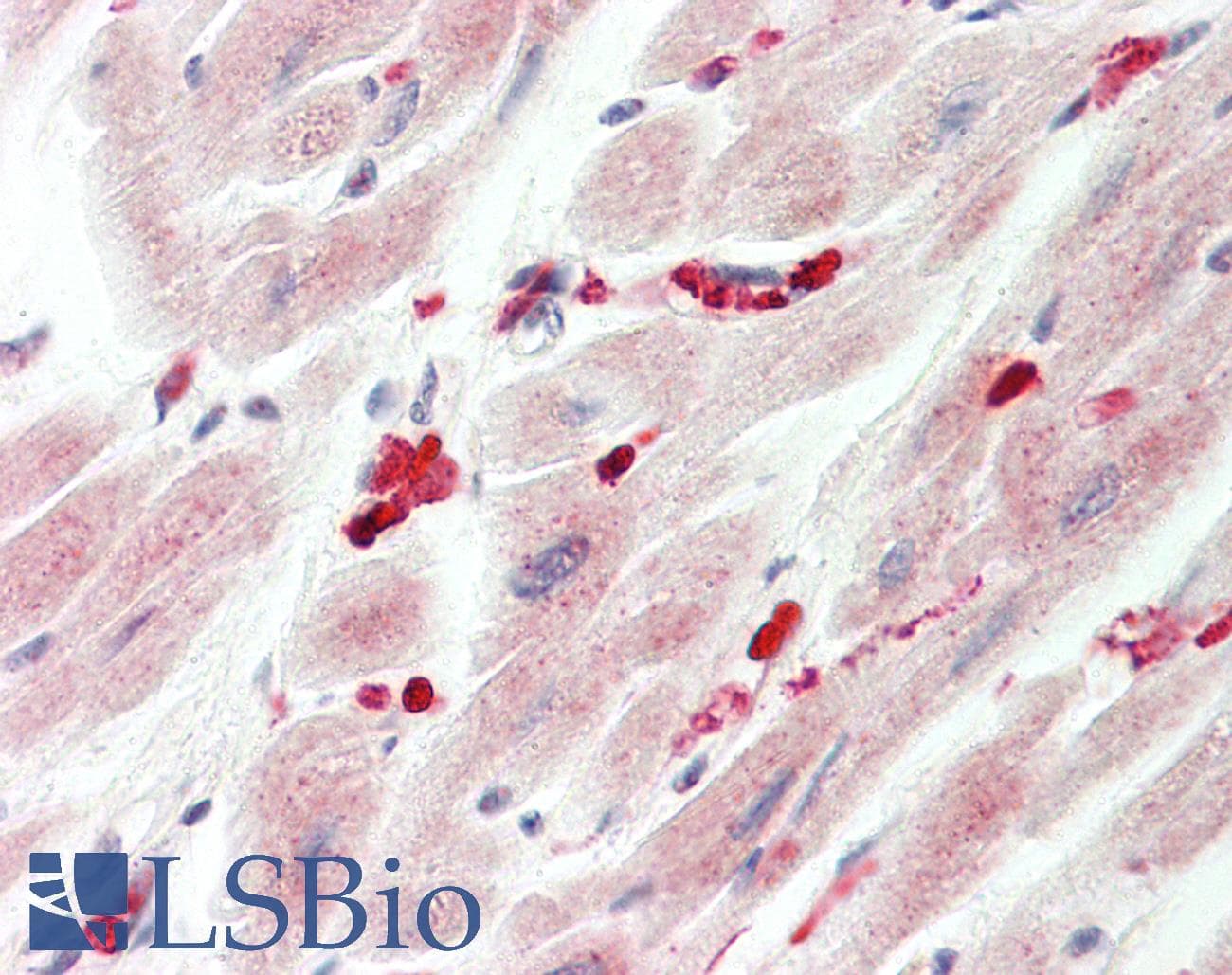 IHC-plus™ ADRB2 Antibody (Thr384)