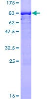 Human TRXR1 / TXNRD1 Protein (Recombinant GST)