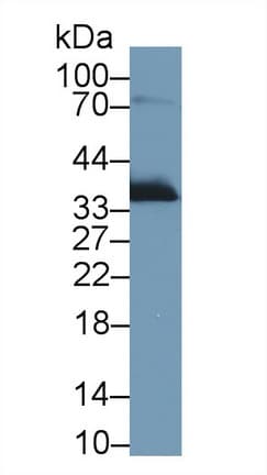 APOE / Apolipoprotein E Antibody (aa19-168)