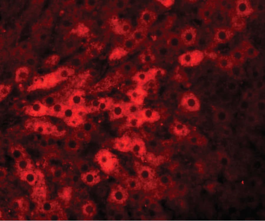 IHC-plus™ TMEM70 Antibody