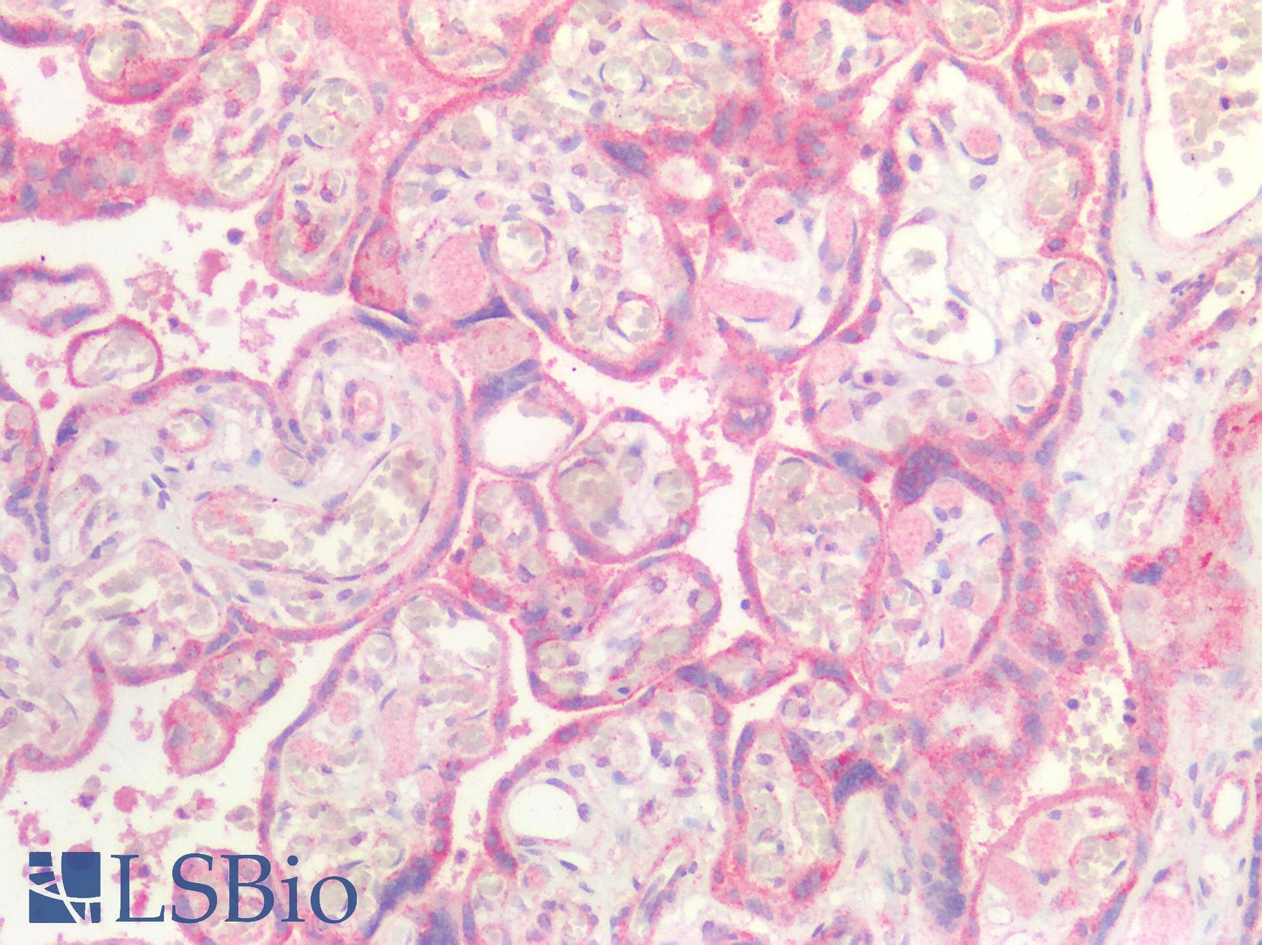 PathPlus™ Polyclonal Rabbit anti-Human GDF15 Antibody (IHC)