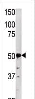 PGK2 Antibody (aa117-145)