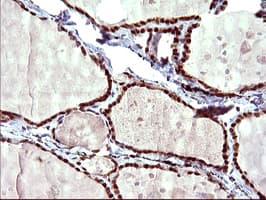 UPRT Antibody (clone OTI1A3)