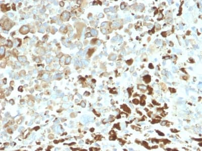 Recombinant Monoclonal Rabbit anti-Human NGFR / CD271 / TNR16 Antibody (clone NGFR/2550R, Azide-free,Carrier-free, aa 281-421, IHC)