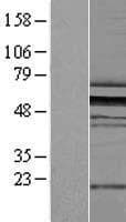 ZPR1 / ZNF259 Protein (Over-Expression Lysate Myc-DDK (Flag))