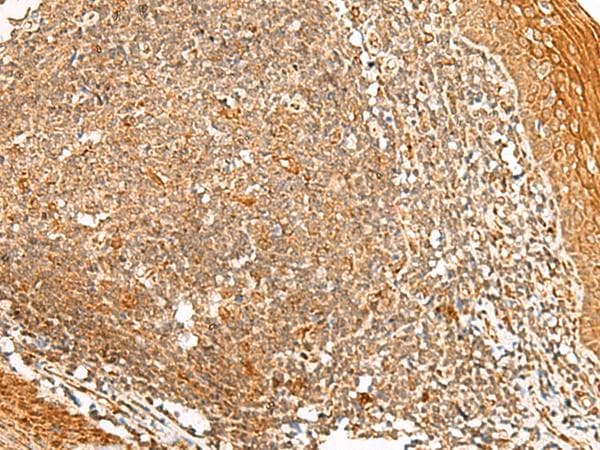 PPOX Antibody