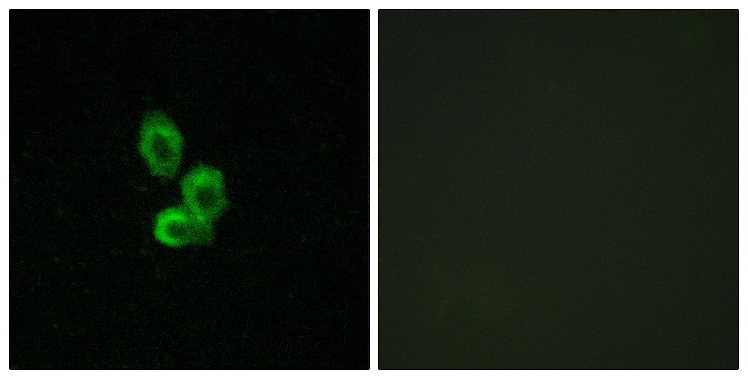 Polyclonal Rabbit anti-Human PDGFRB / PDGFR Beta Antibody (p752, IHC, IF, WB)