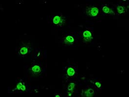 TRIB2 Antibody (clone OTI8D11)