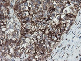 PDIA3 / ERp57 Antibody (clone OTI3E1)