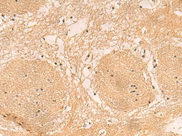 EMC1 Antibody