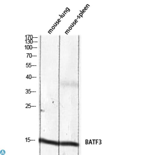 Polyclonal Rabbit anti-Human BATF3 Antibody (IHC, WB)