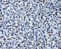 SORD / Sorbitol Dehydrogenase Antibody (clone OTI15H2)