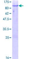 Human CBFA2T3 Protein (Recombinant GST)