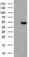 Monoclonal Mouse anti-Human GSS / Glutathione Synthetase Antibody (clone OTI1H3, WB)