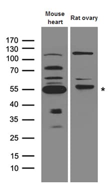 Polyclonal Rabbit anti-Human MMP11 Antibody (WB)