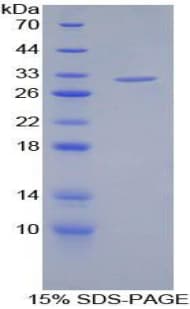 Human ABP-280 / FLNC Protein (Recombinant His-T7)