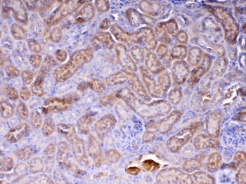 AMD / AMD1 Antibody