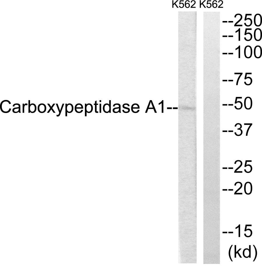 Polyclonal Rabbit anti-Human CPA1 / Carboxypeptidase A Antibody (IHC, WB)