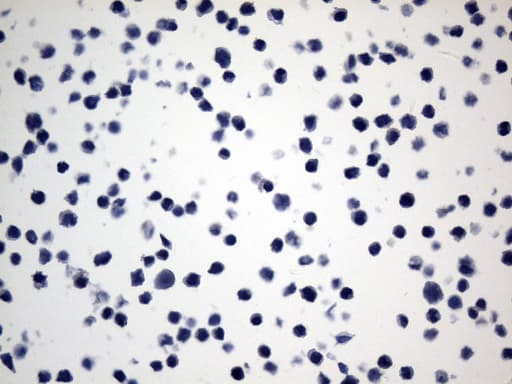 ACTA2 / Smooth Muscle Actin Antibody (N-Terminus, clone UMAB237)