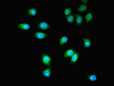 PDGFRB / PDGFR Beta Antibody