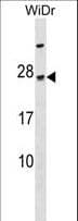 TGIF2LY Antibody (aa1-28)