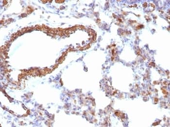 Muscle Actin Antibody (clone MSA/953)