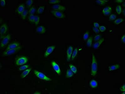 Polyclonal Rabbit anti-Human FKBP11 Antibody (IHC, WB)