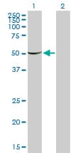 PGM1 / Phosphoglucomutase 1 Antibody (clone 3B8-H4)