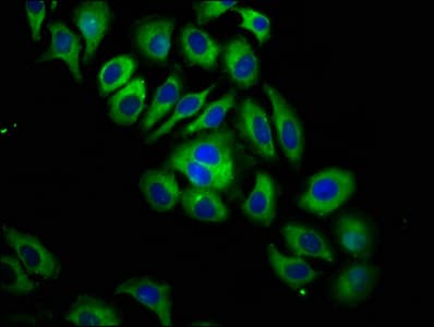 ITGB6 / Integrin Beta 6 Antibody