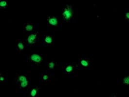 GATM / AGAT Antibody (clone OTI1E3, Carrier-free)