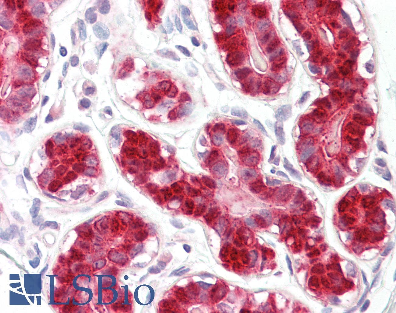 IHC-plus™ DDX58 / RIG-1 / RIG-I Antibody (aa200-250)