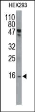 SUMO1 / SMT3 Antibody