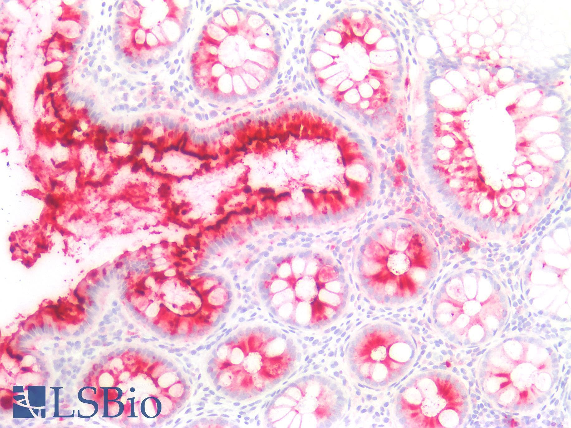 PathPlus™ Sialylated Lewis a / CA 19-9 Antibody (clone 121SLE, Concentrated)