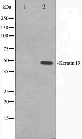 KRT19 / CK19 / Cytokeratin 19 Antibody