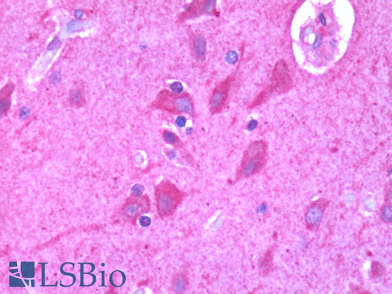 PathPlus™ LPAR2 / EDG4 Antibody (Cytoplasmic Domain)