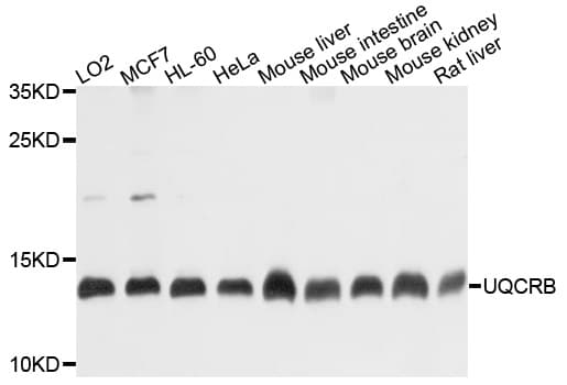 UQCRB Antibody