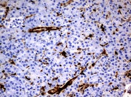 TP / Thymidine Phosphorylase Antibody (clone OTI5B5)