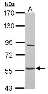 Polyclonal Rabbit anti-Human ABHD16A / BAT5 Antibody (IHC, WB)