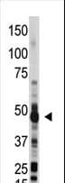 Polyclonal Rabbit anti-Human OAS1 Antibody (aa302-330, IHC, WB)