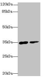Polyclonal Rabbit anti-Human RNF148 Antibody (IHC, WB)