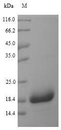 Staphylococcus aureus CHIPS Protein (Recombinant 6His, N-terminus)