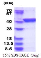 Human LANCL1 Protein (Recombinant His)