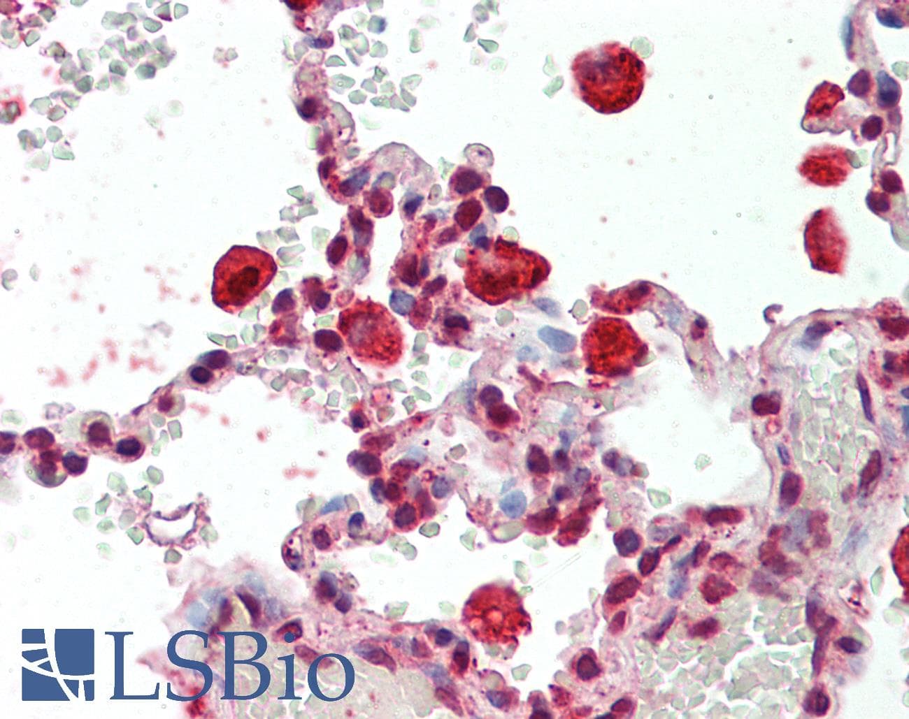 IHC-plus™ CAPG Antibody