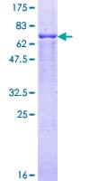 Human PSMC2 / RPT1 Protein (Recombinant GST)