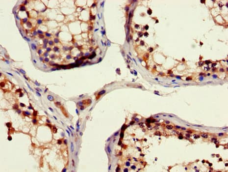 RAD54B Antibody